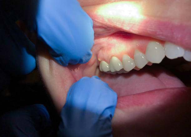 Best Urgent Care for Lost Fillings or Crowns in Buckeye, AZ